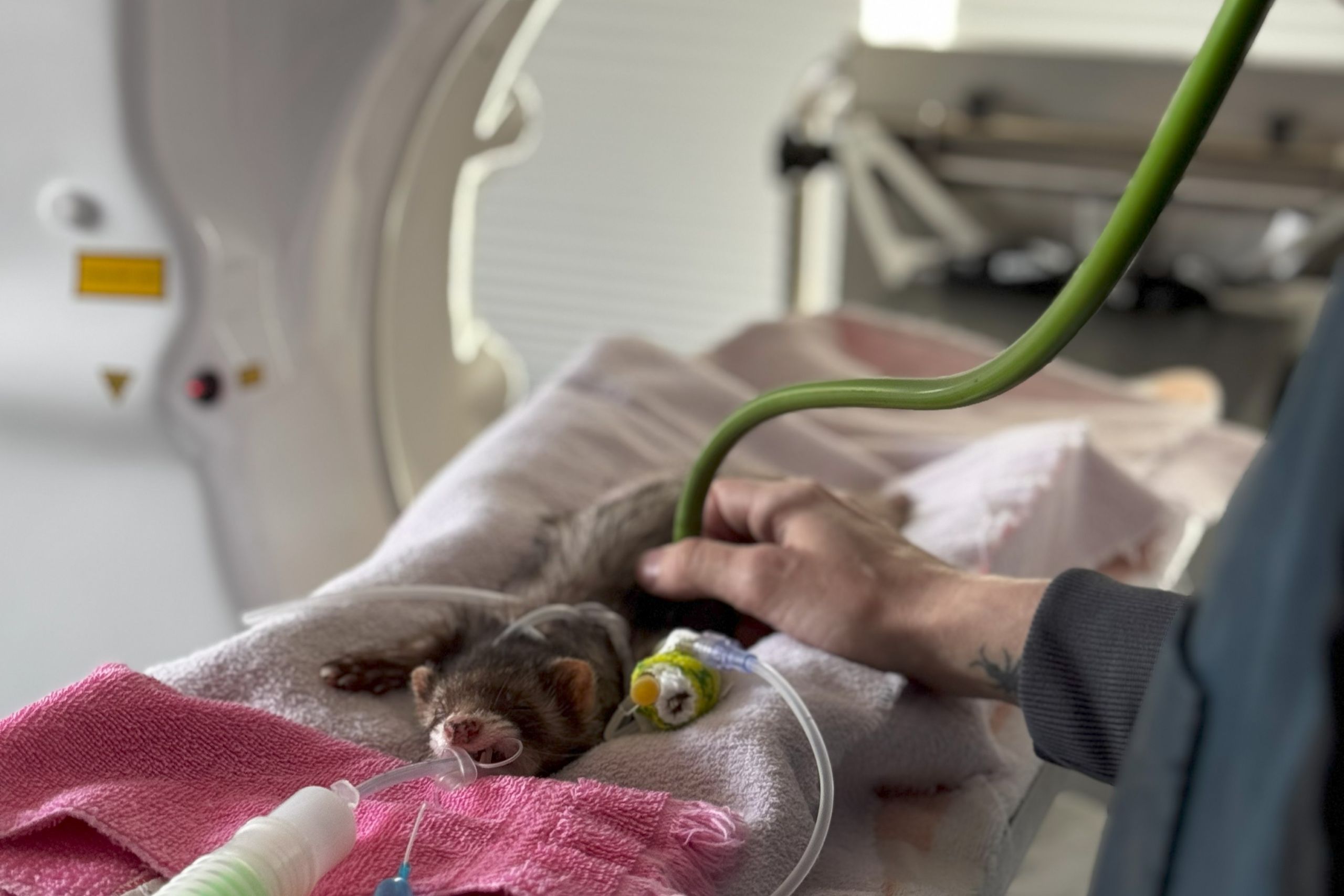 Advanced CT Scanner Features